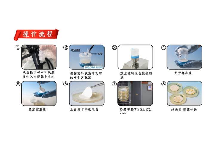 1704185307310378.jpg 內鏡操作步驟.jpg